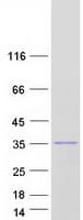 Human RNASEH2B Protein (Recombinant Myc-DDK (Flag))