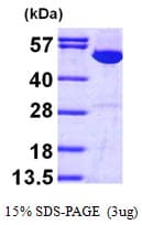 Human IMPDH1 Protein (Recombinant His)