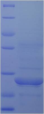 Human LRP4 Protein (Recombinant His)