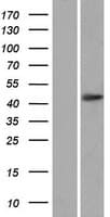 OTUD3 Protein (Over-Expression Lysate Myc-DDK (Flag))
