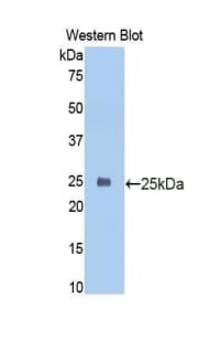 CDH2 / N Cadherin Antibody (aa45-238)
