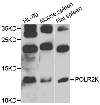 Polyclonal Rabbit anti-Human POLR2K Antibody (WB)