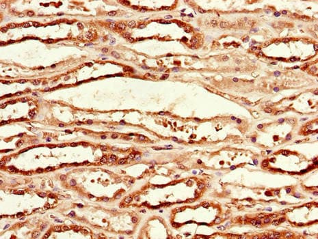 MCL1 / MCL 1 Antibody