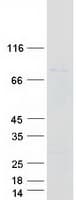 Human ECD Protein (Recombinant Myc-DDK (Flag))
