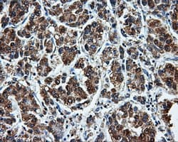 LEMD3 / MAN1 Antibody (clone OTI6C10, Carrier-free)