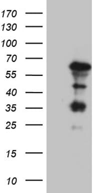 KLF5 / BTEB2 Antibody (aa1, clone OTI1D6)