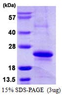 Human MYL12A / MRCL3 Protein (Recombinant His)