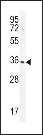 Polyclonal Rabbit anti-Human IGFBP3 Antibody (Ser183, IHC, WB)