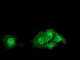 DTNA / Dystrobrevin Alpha Antibody (clone OTI1A2)