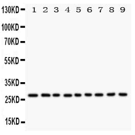 KLK6 / Kallikrein 6 Antibody (aa227-244)