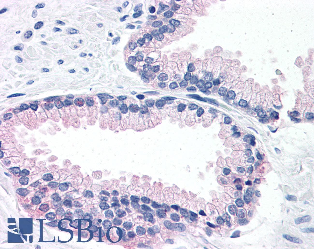 IHC-plus™ LOXL2 Antibody (N-Terminus)