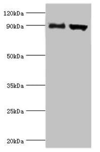 Polyclonal Rabbit anti-Human ADAM9 Antibody (aa475-685, IHC, WB)