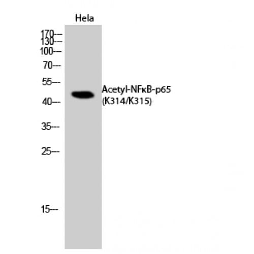 Polyclonal Rabbit anti-Human RELA / NFKB p65 Antibody (around the acetylation site of K314/K315., WB)