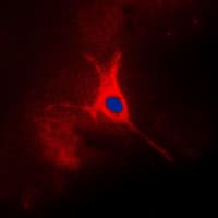 IHC-plus™ TROP2 / TACSTD2 Antibody (Internal)