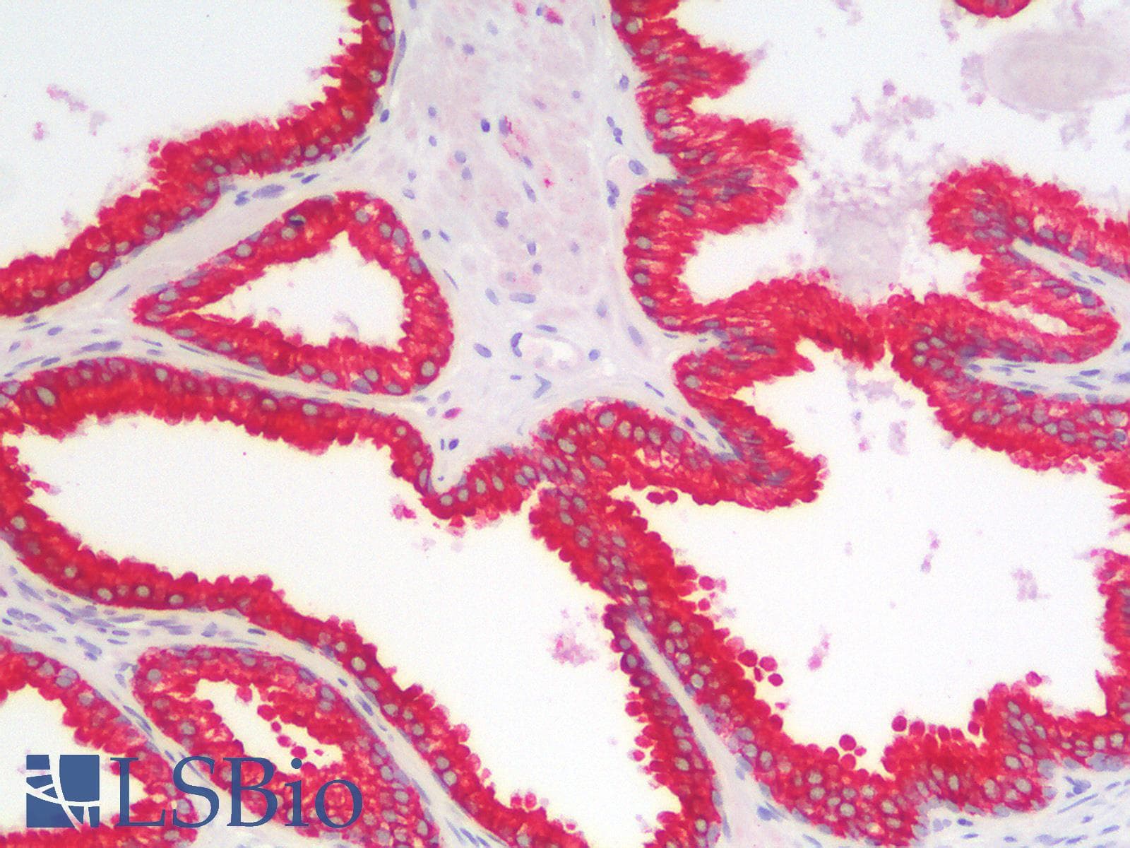 PathPlus™ KRT18 / CK18 / Cytokeratin 18 Antibody