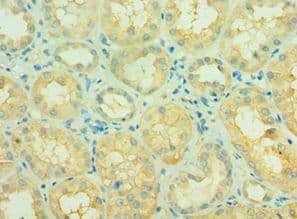 SIRT3 / Sirtuin 3 Antibody (aa20-130)