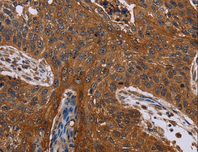 JUP/CTNNG/Junction Plakoglobin Antibody