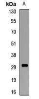 FCGR3A / CD16A Antibody