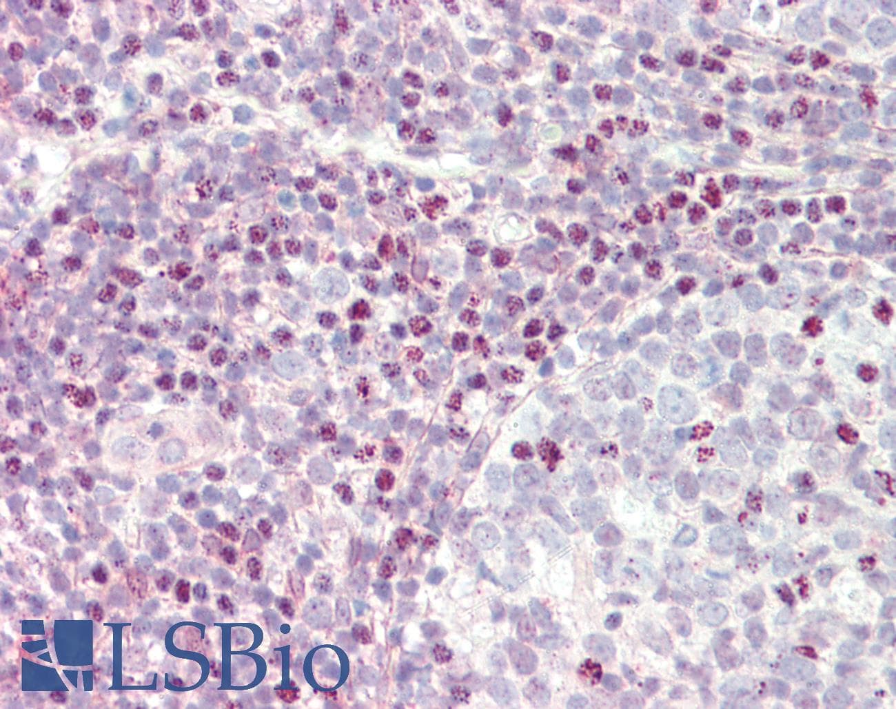 IHC-plus™ Polyclonal Rabbit anti-Human CTCF Antibody (C-Terminus, IHC, WB)
