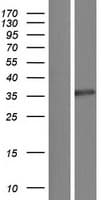 PPP6C Protein (Over-Expression Lysate Myc-DDK (Flag))