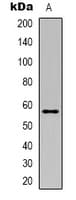 CORO1A / Coronin 1a Antibody (Internal)