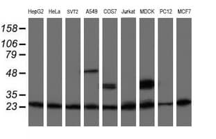 PSMB9 Antibody (aa21-219, clone OTI2G6)