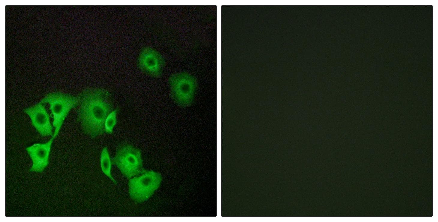 Polyclonal Rabbit anti-Human TTF2 / HuF2 Antibody (IF)