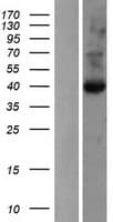 GLIPR1 / GLIPR Protein (Over-Expression Lysate Myc-DDK (Flag))