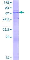 Human MTMR1 Protein (Recombinant GST)