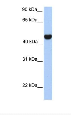 Polyclonal Rabbit anti-Human RTN4 / Nogo Antibody (FITC, aa254-303, WB)