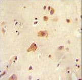 ARHGAP44 Antibody (aa784-811)
