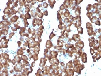 ODC1 / Ornithine Decarboxylase Antibody (clone ODC1/487)