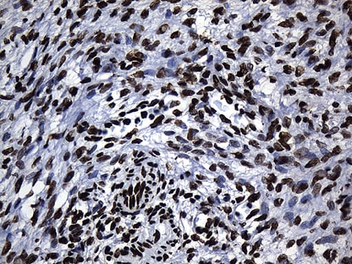 HNRNPH1 / hnRNP H Antibody (clone OTI2D11, Carrier-free)