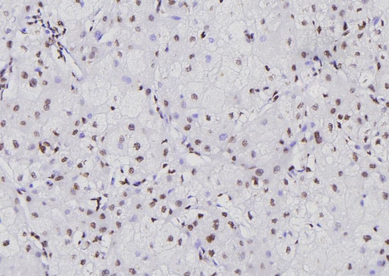 Polyclonal Rabbit anti-Human NFATC1 / NFAT2 Antibody (IHC, WB)