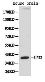 Polyclonal Rabbit anti-Human SIRT2 / Sirtuin 2 Antibody (IHC, WB)