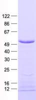 Human FBXO22 Protein (Recombinant His, N-Terminal)