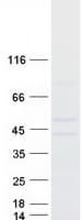 Human CHST12 Protein (Recombinant Myc-DDK (Flag))