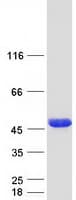 Human ALS2CR1 / NIF3L1 Protein (Recombinant Myc-DDK (Flag))