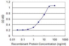 IHC-plus™ OTUD7B / Cezanne Antibody (clone 2B4)