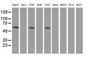 Monoclonal Mouse anti-Human PKLR Antibody (clone OTI1A5, WB)