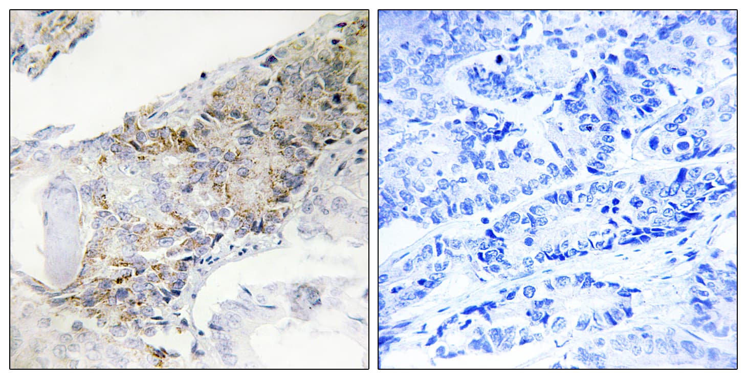 Polyclonal Rabbit anti-Human COX5B Antibody (aa11-60, IHC)