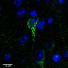 CRFR1 / CRHR1 Antibody (aa107-117)