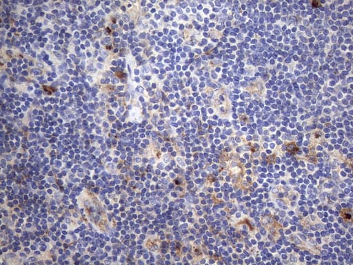 CRP / C-Reactive Protein Antibody (clone OTI1G10)