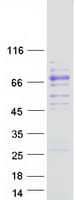 Human F10 / Factor X Protein (Recombinant Myc-DDK (Flag))