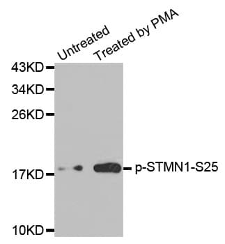 Polyclonal Rabbit anti-Human STMN1 / Stathmin / LAG Antibody (phospho-Ser25, IHC, WB)