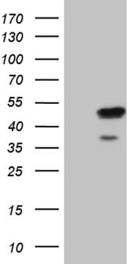 ELF3 / ESE1 Antibody (aa175-286, clone OTI5G5)