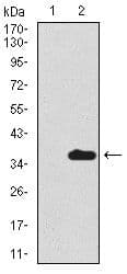 Monoclonal Mouse anti-Human SCGB1A1 / Uteroglobin Antibody (clone 3A8B8, Amino Acid: 26-91, WB)