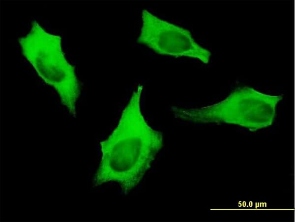 IHC-plus™ Monoclonal Mouse anti-Human MYH9 Antibody (clone 4H3, IHC, IF, WB)