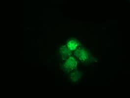 HSPA6 / HSP70B' Antibody (clone OTI1H3)