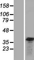 GEMIN8 Protein (Over-Expression Lysate Myc-DDK (Flag))